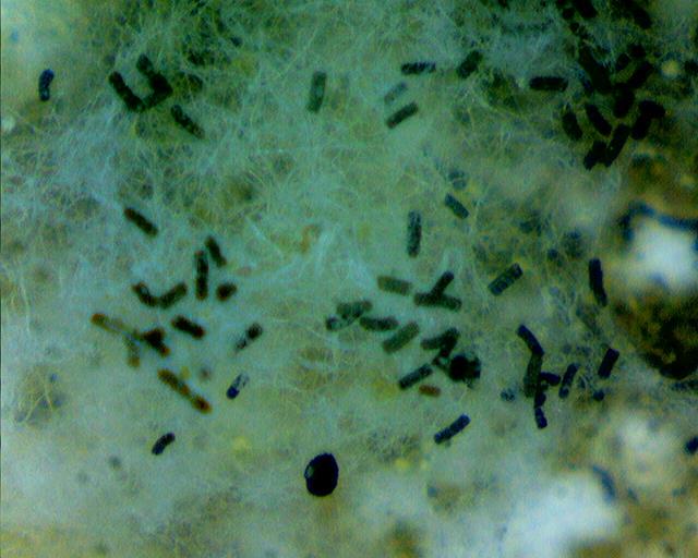 USUWANIE PLEŚNI - Aspergillus o budowie kolumnowej konidioforów