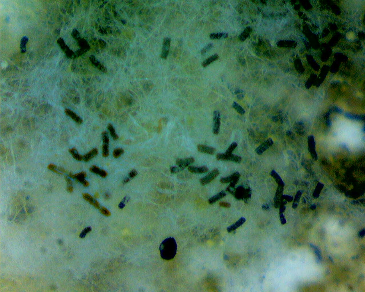 grzyby strzępkowe widziane pod mikroskopem - foto Waigel