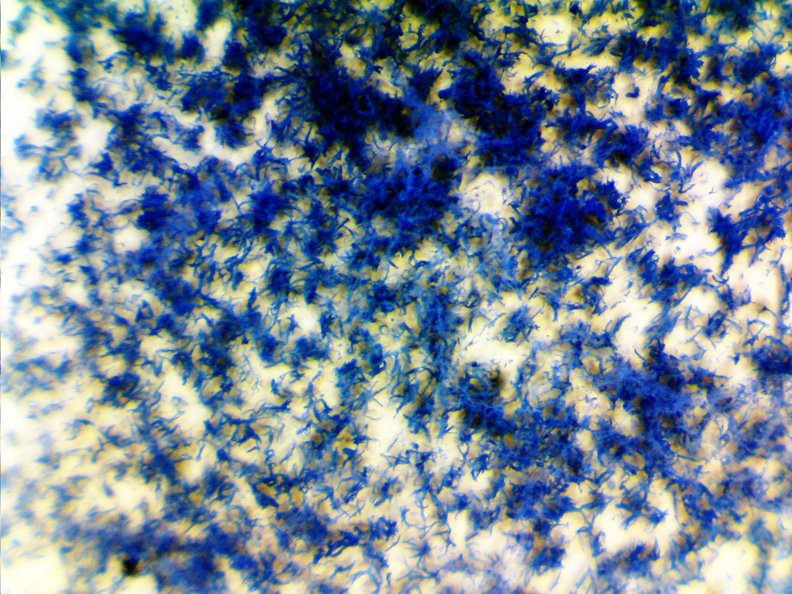 konidia Penicillium sp. - grzyby pleśnie widziane pod mikroskopem - foto Waigel.